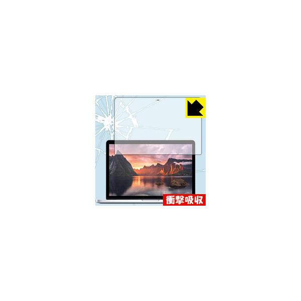 MacBook Pro 13C`(2015Nf) fނŏՌzIیtB Ռzyz