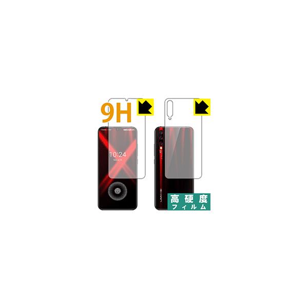 UMIDIGI X ywFؑΉz PETtBȂ̂ɋKX̍dxIیtB 9Hdxyz ()