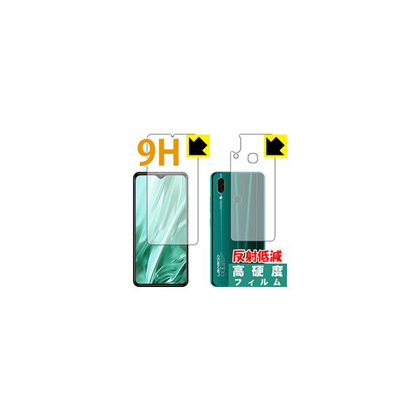 LEAGOO S11 PETtBȂ̂ɋKX̍dxIیtB 9Hdxy˒ጸz (ʃZbg)