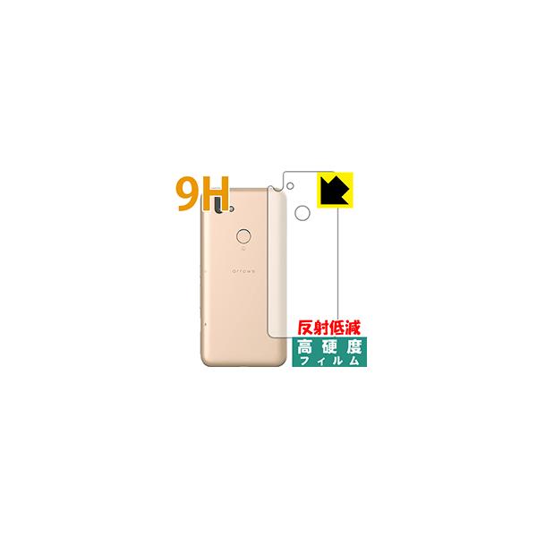 arrows RX PETtBȂ̂ɋKX̍dxIیtB 9Hdxy˒ጸz (w)