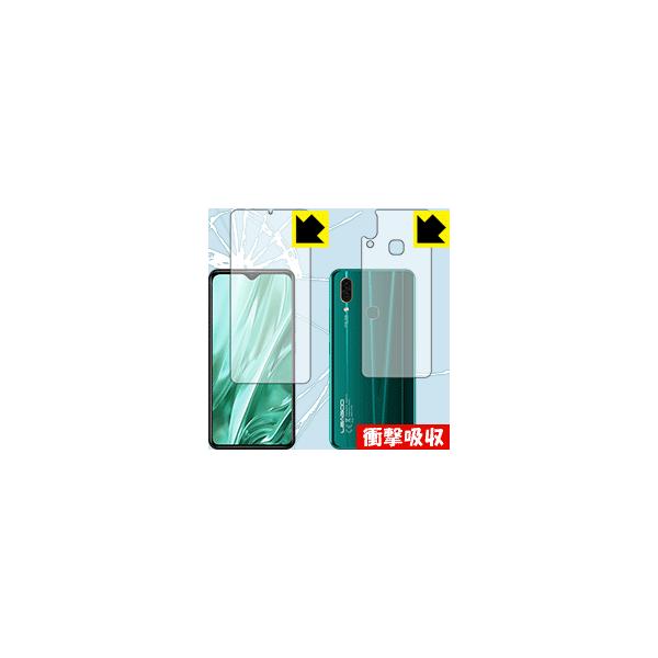 LEAGOO S11 fނŏՌzIیtB Ռzyz (ʃZbg)