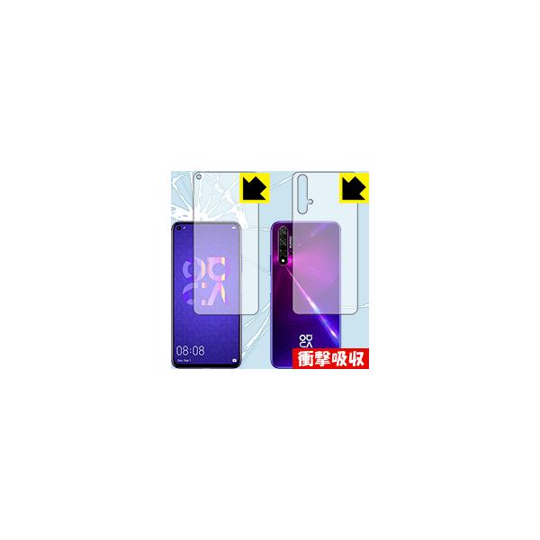 HUAWEI nova 5T fނŏՌzIیtB Ռzyz (ʃZbg)