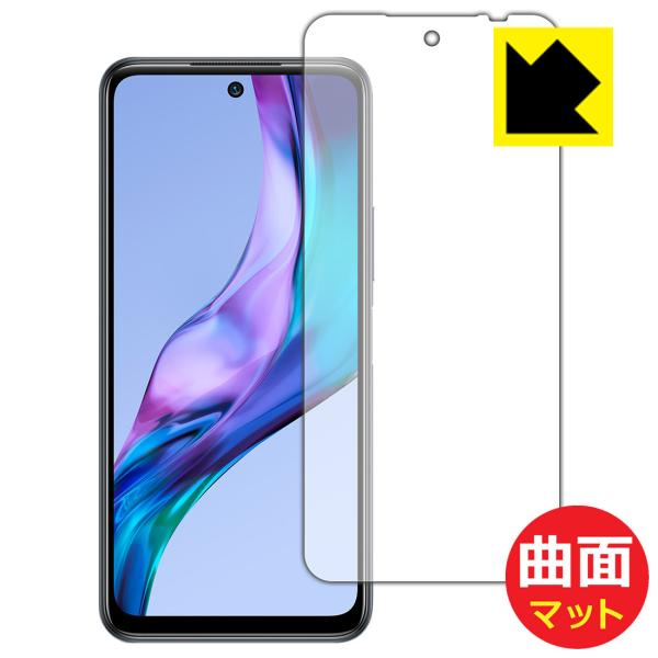 Xiaomi Redmi Note 10TΉ Flexible Shield Matte[˒ጸ] ی tB [Oʗp] ȖʑΉ {