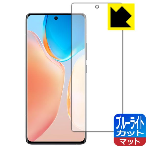 vivo X70 Pro LED�t����ʂ̃u���[���C�g��34%�J�b�g�I�ی�t�B���� �u���[���C�g�J�b�g�y���˒ጸ�z �y�w��F�ؑΉ��z