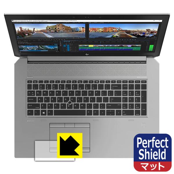 HP ZBook 17 G5 Mobile Workstation y4K ^b`plڃfz hCAEhw!˒ጸیtB Perfect Shield (^b`pbhp) 3Zbg