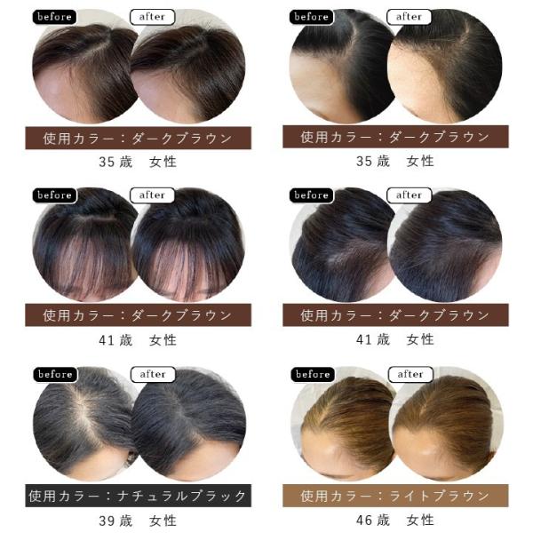 ララチュー Lalachuu ヘアファンデーション 白髪 小顔 韓国 コスメ ファンデ パウダー ハゲ 薄毛 隠し 女性 リタッチ ボリュームアップ Supersport Tn