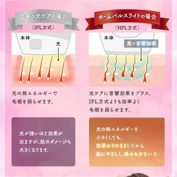 脱毛器 女性 メンズ 光脱毛器 効果 男性 家庭用脱毛器 ヒゲ脱毛 髭 脱毛 安い エピレタ アイリスオーヤマ 37万ショット Ep 0337 P Buyee 日本代购平台 产品购物网站大全 Buyee一站式代购 Bot Online