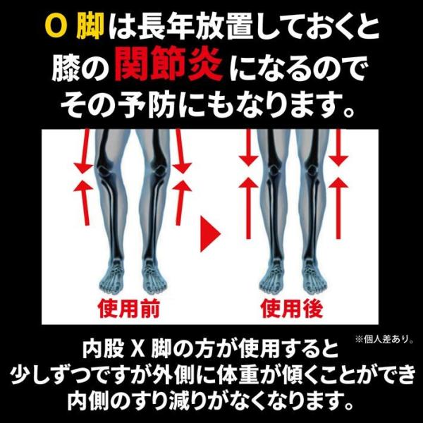 インソール X脚 O脚 矯正 改善 メンズ レディース かかと シリコン ゲル パッド クリア /X脚O脚透明インソール2足分4枚 /【Buyee】 インソール X脚 O脚 矯正 改善 メンズ レディース かかと シリコン ゲル パッド クリア /X脚O脚透明インソール2足分4枚 /【Buyee】