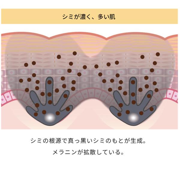 pre-ma_50002-kose-melano-p_5_d_20260421105753