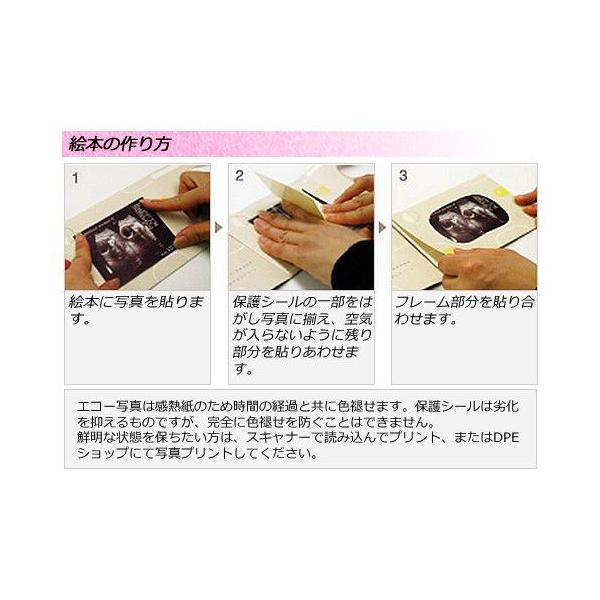 エコー写真 アルバム エコー写真 保存 出産 祝い 手形足形 10ツキ10カ メモリアル 記念絵本 手作りアルバム Buyee Buyee 日本の通販商品 オークションの代理入札 代理購入