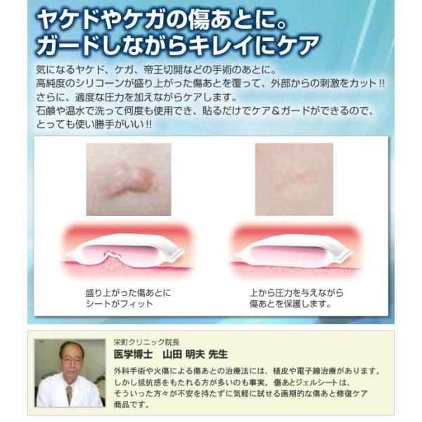 傷跡 やけど 手術痕 プリマ傷あとジェルシート Buyee Buyee บร การต วกลางจากญ ป น ซ อจากประเทศญ ป น