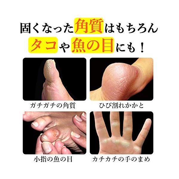 輸入 角質除去 スクラッチ かかと うおのめ 除去 スクラッチかかと角質取り 足 角質 けずり 魚の目