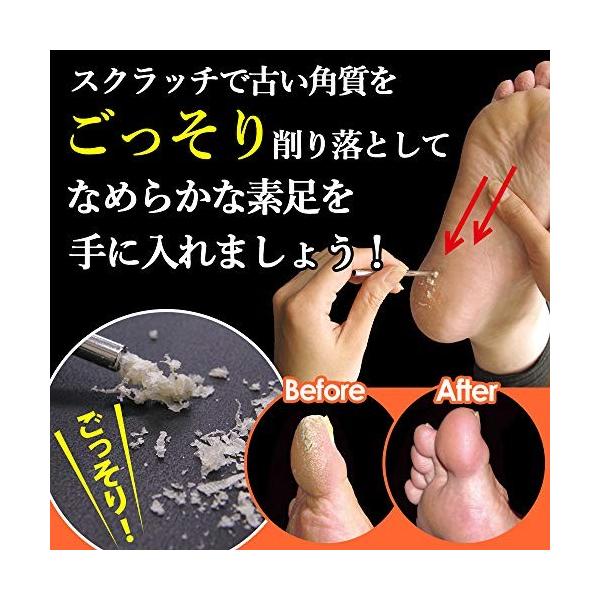 リズム 思春期 機構 魚の目 スクラッチ Aupaysdusoleillevant Com