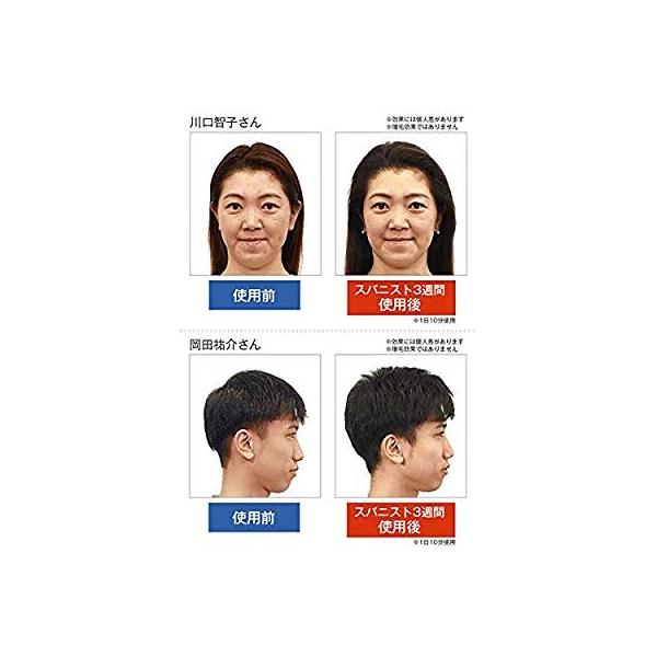 アデランス ヘッドスパ