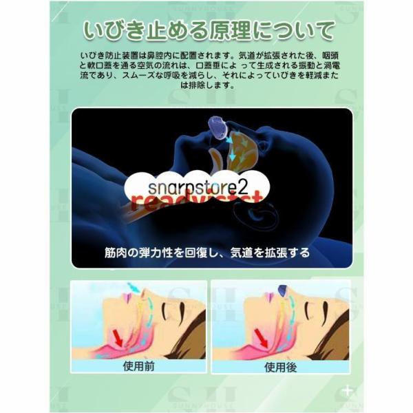 いびき防止 いびき対策 男女兼用 いびき軽減 快眠 鼻呼吸 いびき改善 楽天市場】人気 いびき防止 グッズ イビピタンネックピロー 鼻 喉