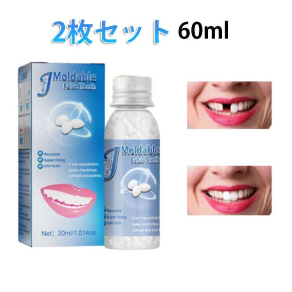 歯の修復ツール 仮歯 一時的 穴埋め 樹脂ビーズ 入れ歯 成形可能 樹脂ビーズ 固形接着剤 隙間埋め 応急処置 義歯 修正 歯の欠け 差し歯 入れ歯
