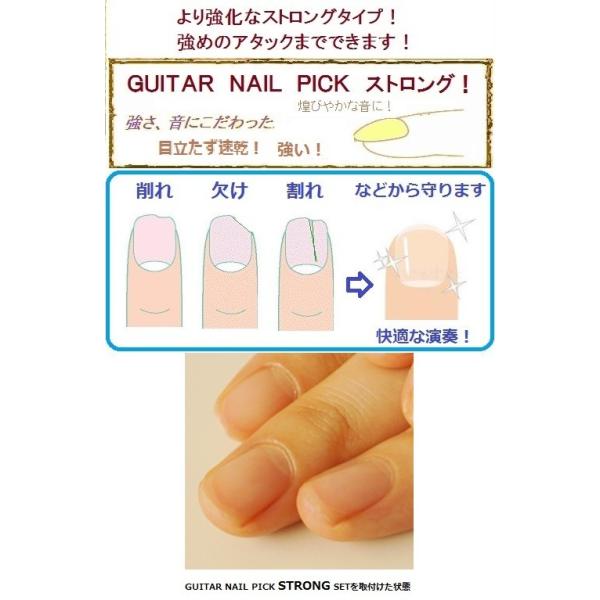 ギターネイルピックストロングセットd Guitar Nail Pick Strong Set D ギター用爪強化 爪補強セット 送料無料 Buyee 日本代购平台 产品购物网站大全 Buyee一站式代购