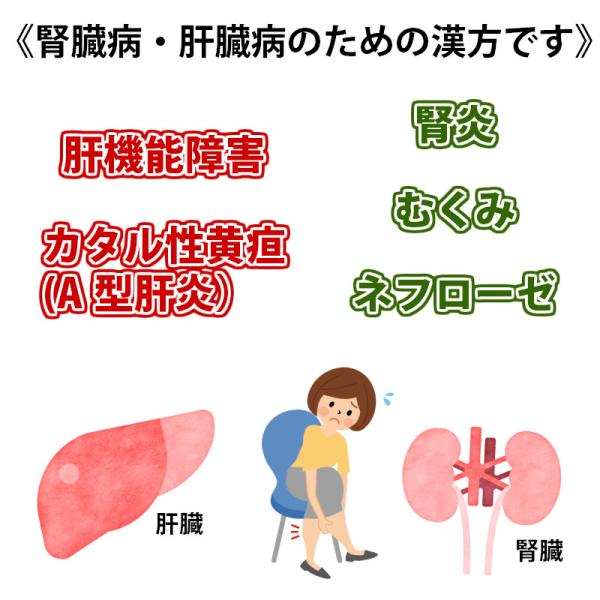 肝臓機能障害 腎炎 ジヨッキ 450錠 ネフローゼ むくみ 黄疸 漢方 第3類医薬品 ホノミ剤盛堂薬品 Buyee Buyee Japanischer Proxy Service Kaufen Sie Aus Japan