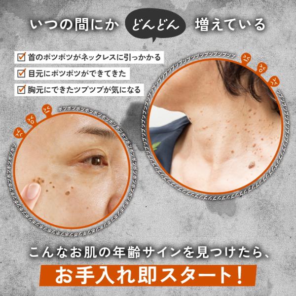 イポツルン習慣美容液 （医薬部外品）首元 目元 胸元 ポツポツ ツブツブ ニキビ 肌荒れ 荒れ性 しもやけ ひび 健やか 汗疹（あせも）首筋 肩周り 胸元 デコルテ