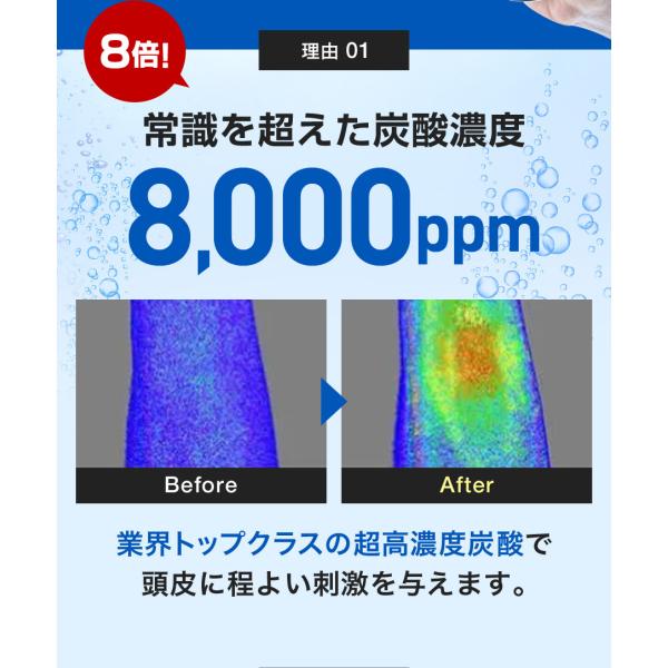Forteroカーボニックスカルプシャンプー(150g) 1本 湿気によるベタつき