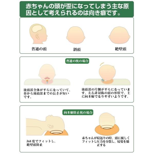 Adokoo ベビーまくら 向き癖防止枕 絶壁頭 斜頭 変形 猫背 寝姿を矯 正 頭の形が良くなる 男女兼用 汗とり 快眠 低反発ピロー 綿