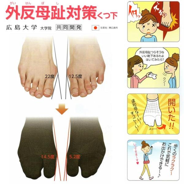 違和感なく1日中着用でき、歩きやすい外反母趾用くつ下です。違和感がない押圧機能(パッド)採用。高伸縮性〜足指保護と通気性の確保。袋構造【母趾（親指）と他趾を分割】低伸縮性と高伸縮性の組合せ〜足全体と母趾（親指）を自然な形で固定。内側に内縫し...