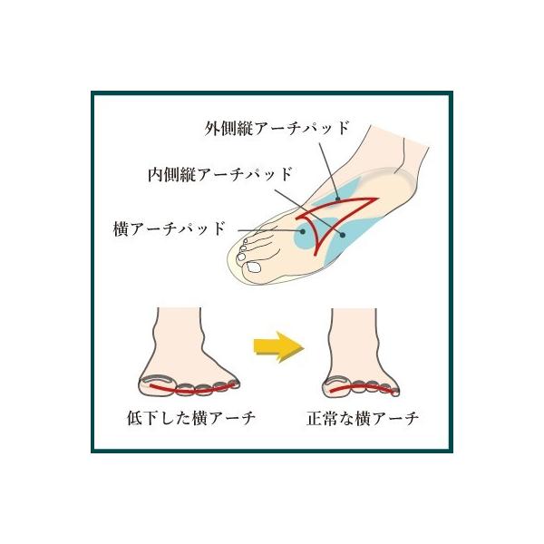 インソールプロ 外反母趾 対策 中敷き インソール 衝撃吸収 内反小趾 レディース Buyee Buyee 提供一站式最全面最專業現地yahoo Japan拍賣代bid代拍代購服務 Bot Online
