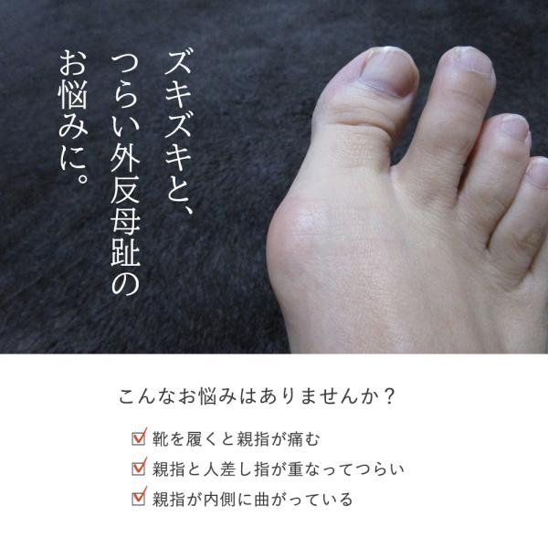 足指サポーター 外反母趾 Sincerus 足指矯正 足指広げ サポータ グッズ 柔らか ケア 2個セット 21 親指広げシリコン Buyee Buyee Japanese Proxy Service Buy From Japan Bot Online