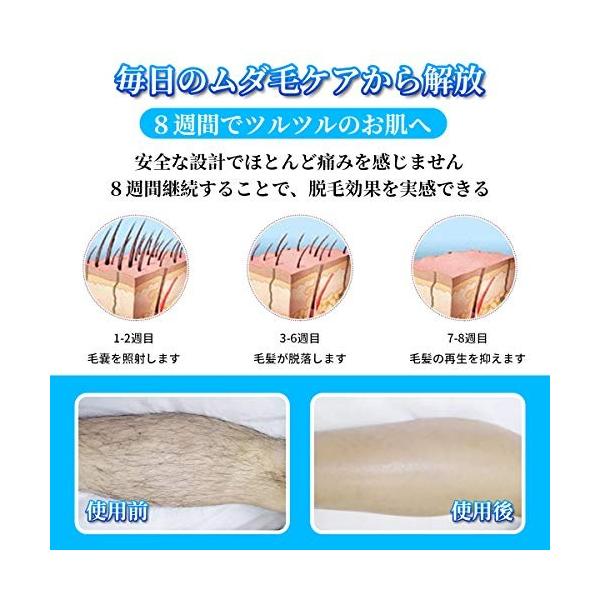 脱毛器 レーザー 永久脱毛 光脱毛器 レディース メンズ 定番の人気シリーズpoint ポイント 入荷 光 50回照射回数 Ipl技術 5段階 家庭用 フラッシュ式 Lcdスクリーン搭載