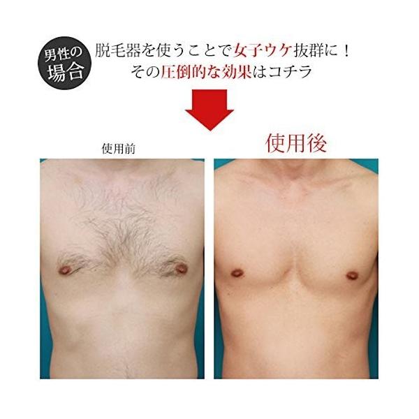 自宅で簡単光脱毛家庭用レーザー脱毛器ipl光美容器レーザー式脱毛機スキンサイエンス安心安全設計永久脱毛光脱毛クリアベールむだ毛ひげ男女兼用