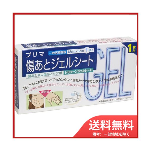 傷あとや火傷あとケア用！貼っておくだけで、とてもカンタン！傷あとや火傷あとのケア用医療機器です！傷あとジェルシートは、既に欧米日で実績のある傷あと・火傷あとケア用シリコーンジェルシートです。●気になる傷あとや火傷あとなどにただ貼っておくだけ...