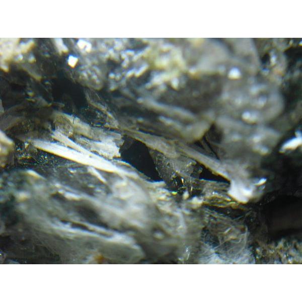 EPIDIDYMITE(GsfBfB}Cg)}EB3247
