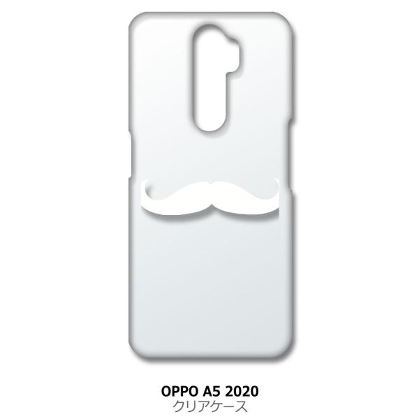 OPPO A5 2020 a52020 �N���A �n�[�h�P�[�X �E �Ђ� �q�Q �i�z���C�g�j �J�o�[ �W���P�b�g �X�}�[�g�t�H�� �X�}�z�P�[�X