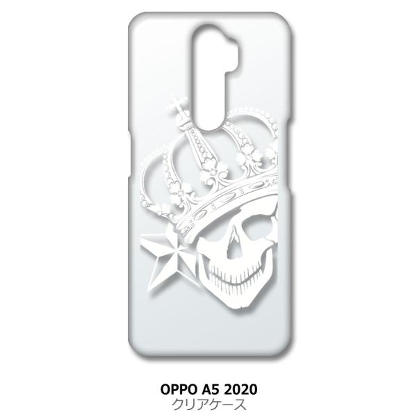 OPPO A5 2020 a52020 �N���A �n�[�h�P�[�X �X�J�� �N���E�� ���� �h�N�� �[�� �i�z���C�g�j �J�o�[ �X�}�[�g�t�H�� �X�}�z�P�[�X