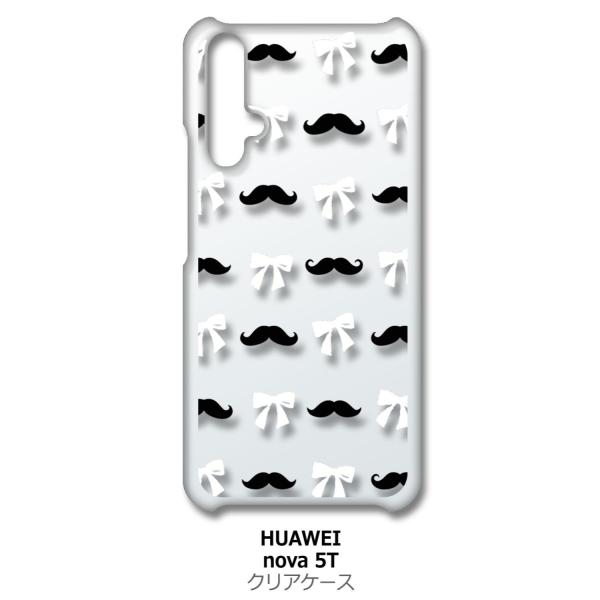 nova 5T HUAWEI nova5t �N���A �n�[�h�P�[�X �Ђ������{��(�u���b�N/�z���C�g) �E �q�Q �X�}�z �P�[�X �X�}�[�g�t�H��