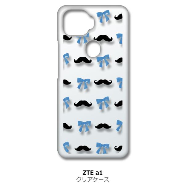 ZTE a1 ZTG01 A1 NA n[hP[X Ђ{(ubN/u[) E qQ X}z P[X X}[gtH J