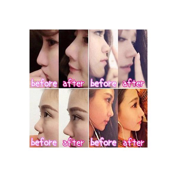 鼻プチ プチ整形 小顔効果 だんご鼻 鼻腔矯正 韓国コスメ ３サイズセット Buyee Buyee บร การต วกลางจากญ ป น ซ อจากประเทศญ ป น