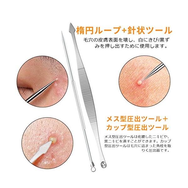 毛穴ケア専用キット 黒ずみ取り 7本セット 角栓 ニキビ取り コメドプッシャー いちご鼻すっきり 毛抜きスティック ピンセット 高精度 ステンレス Buyee Buyee 日本の通販商品 オークションの代理入札 代理購入