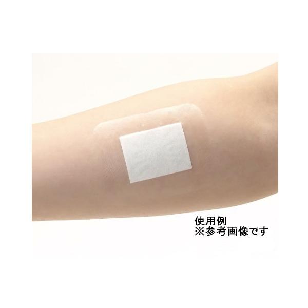 skinix エアウォールふ・わ・りパッド パッド付きフィルムドレッシング