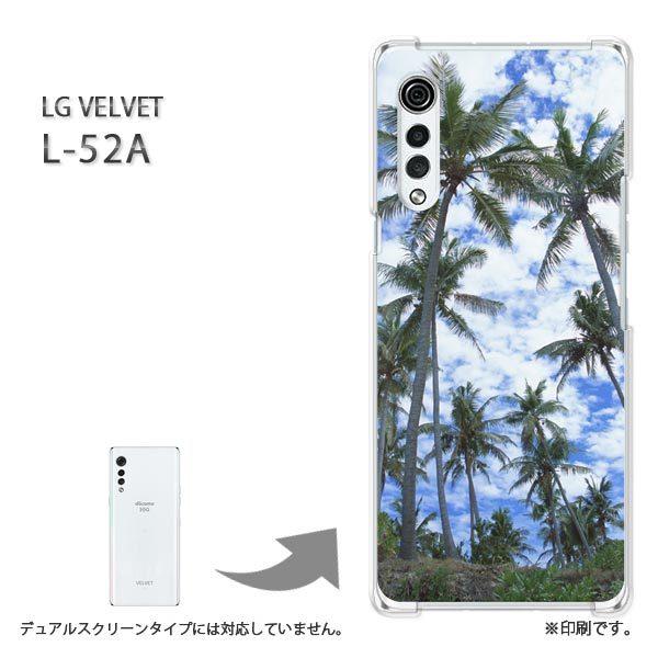 L-52A P[X LG VELVET Jo[ n[hP[X fUC āEVvEV̖؁E(u[)/l52a-pc-new0387