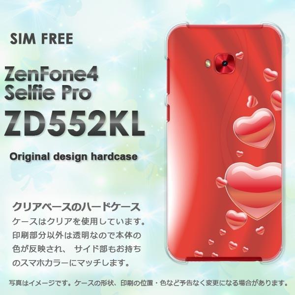 ���� Zen Fone4 Selfie Pro ZD552KL  �n�[�g(��)/zd552kl-pc-new0568