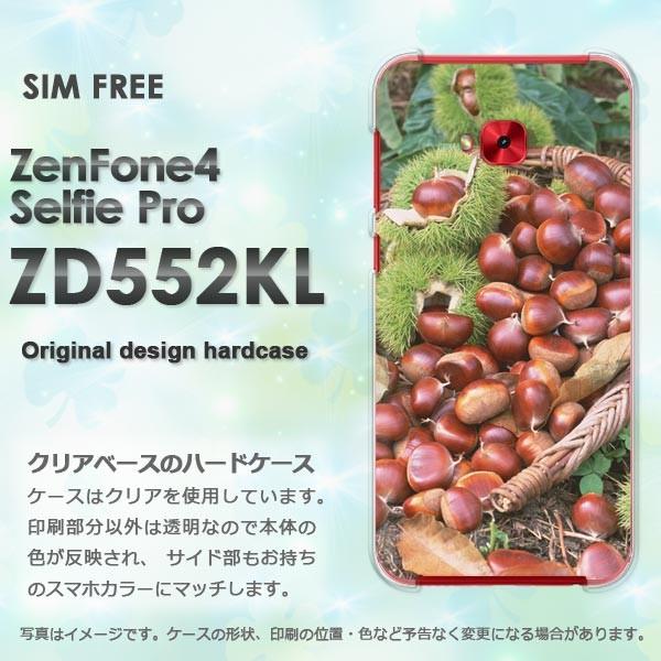  Zen Fone4 Selfie Pro ZD552KL  HEVvEI(uE)/zd552kl-pc-new0589
