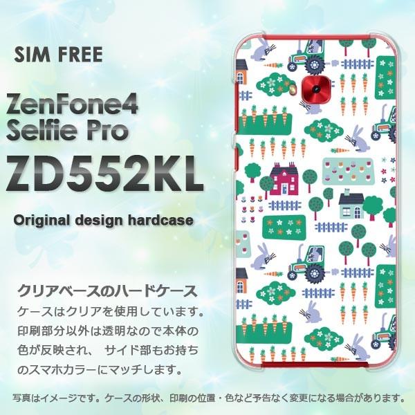  Zen Fone4 Selfie Pro ZD552KL  ()/zd552kl-pc-new0968