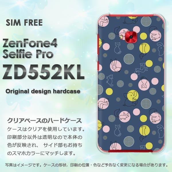  Zen Fone4 Selfie Pro ZD552KL  Ehbg(u[)/zd552kl-pc-new0983