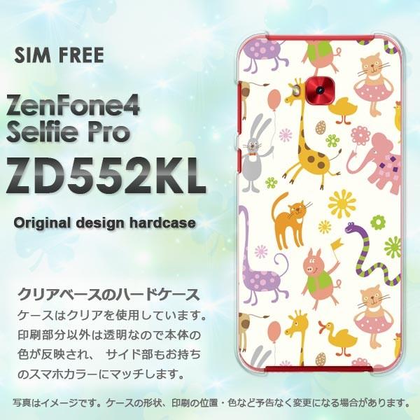  Zen Fone4 Selfie Pro ZD552KL n[hP[X fUC  pXeAj}113/zd552kl-PM113