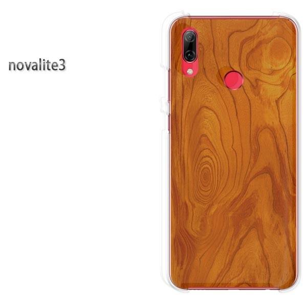 novalite3 HUAWEI �P�[�X �n�[�h �v�����g �n�[�h�P�[�X �X�}�z  �ؖځiA)/novalite3-M991