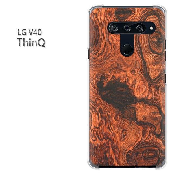  LG V40 ThinQ P[X Jo[ fUC  ؖځiBj/v40-M992
