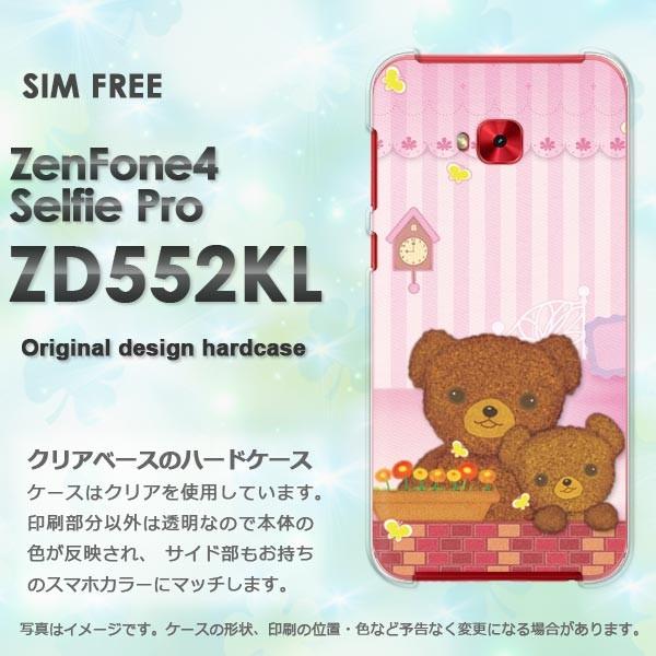  Zen Fone4 Selfie Pro ZD552KL n[hP[X fUC  ܁iAj/zd552kl-M735