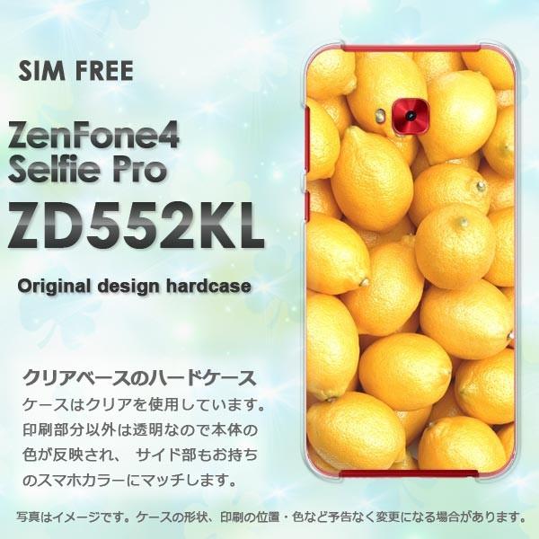  Zen Fone4 Selfie Pro ZD552KL n[hP[X fUC  /zd552kl-M990