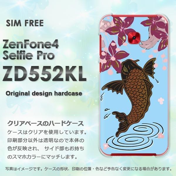  Zen Fone4 Selfie Pro ZD552KL   EVvEaEԁiu[j/zd552kl-pc-ne385